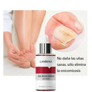 Gotas Antihongos para Uñas y Pies NailCure 1