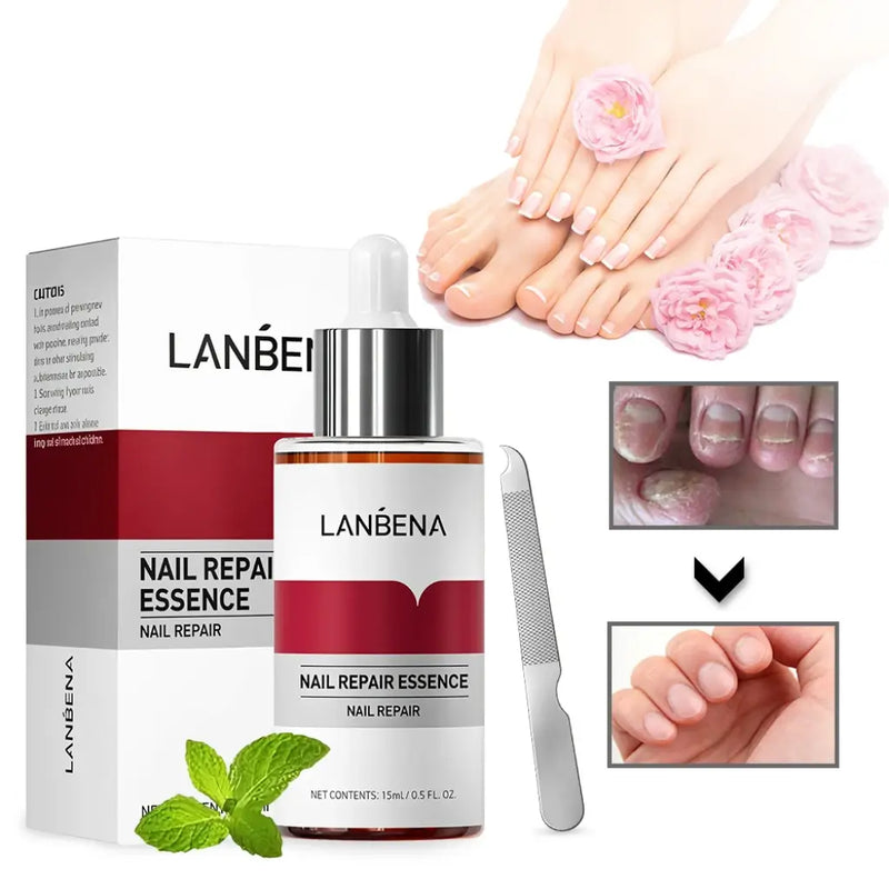 Gotas Antihongos para Uñas y Pies NailCure 2