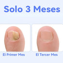 Gotas Antihongos para Uñas y Pies NailCure 3