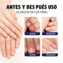 Gotero Antihongos para Uñas con Aceites Naturales 2