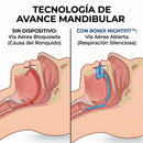 Ilustración médica que compara una vía aérea bloqueada frente a una abierta con la tecnología Ronix.