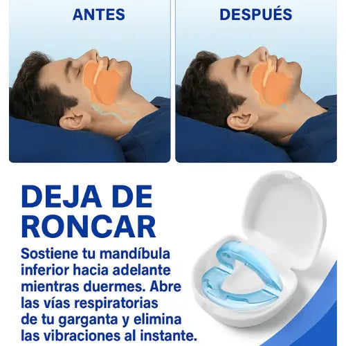 Dispositivo Antirronquidos Ronix NightFit™